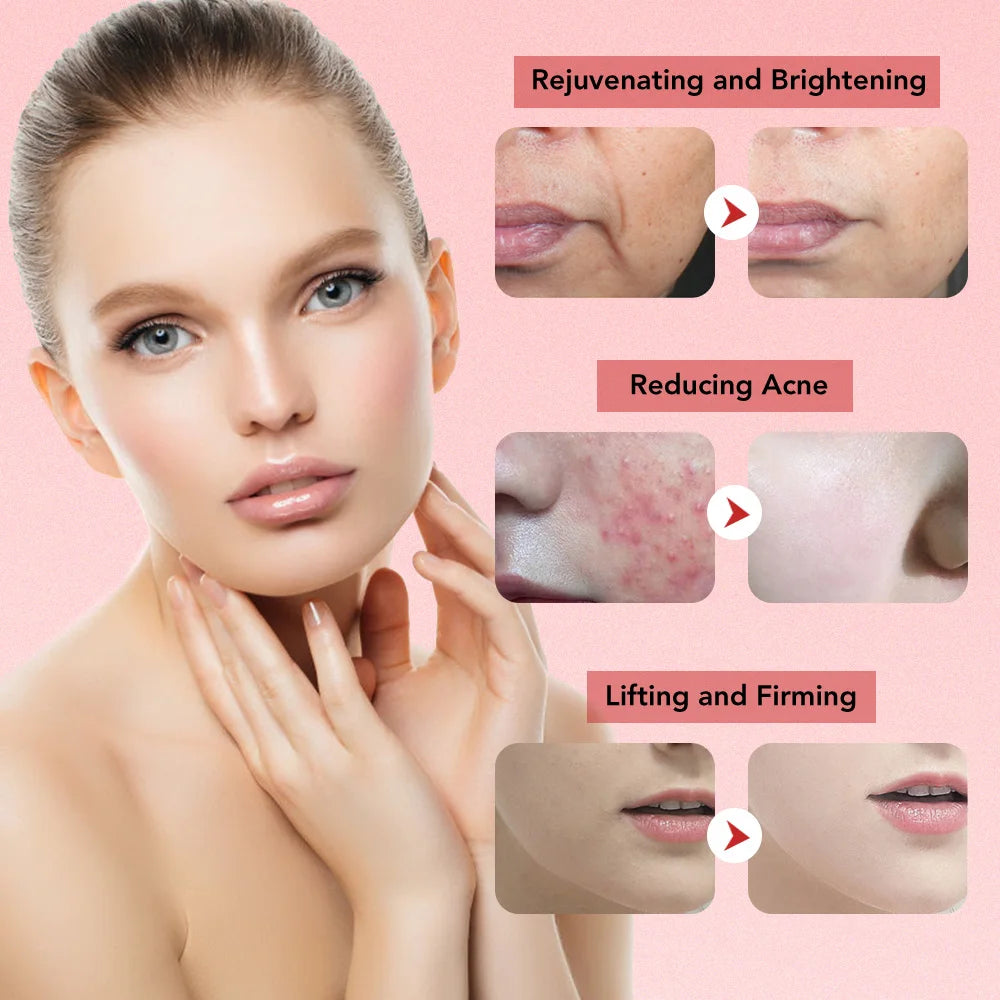 GlowLift™ EMS Facial Massager